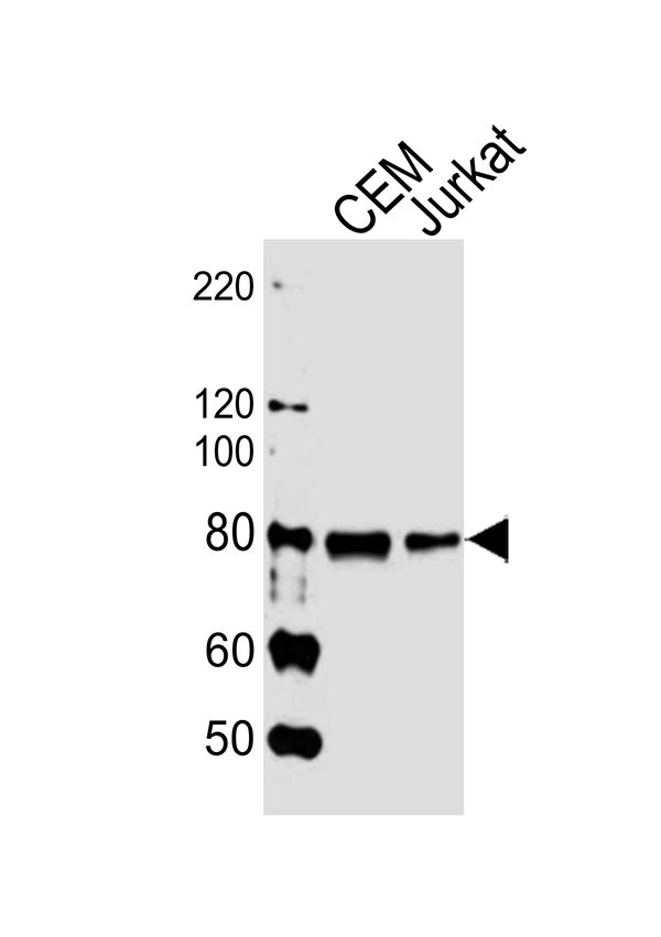 Lane 1: CEM cell lysates; Lane 2: Jurkat cell lysates probed with MYB (1279CT309.289) Monoclonal Antibody, unconjugated (bsm-51421M) at 1:1000 overnight at 4°C followed by a conjugated secondary antibody for 60 minutes at 37°C.