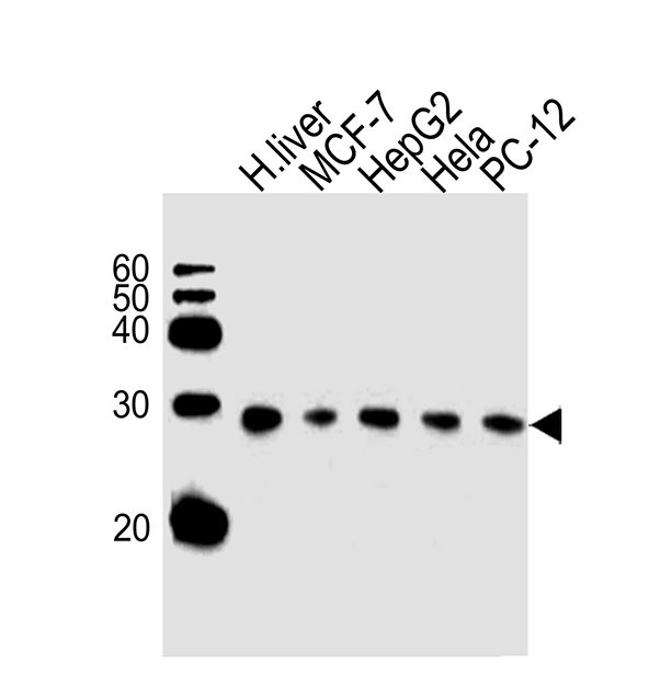 Lane 1: Human Liver Lysates; Lane 2: MCF-7 Cell Lysates; Lane 3: HepG2 Cell Lysates; Lane 4: HeLa Cell Lysates; Lane 5: PC-12 Cell Lysates; probed with PSMA5 (426CT8.5.1) Monoclonal Antibody, unconjugated (bsm-51389M) at 1:1000 overnight at 4°C followed by a conjugated secondary antibody for 60 minutes at 37°C.