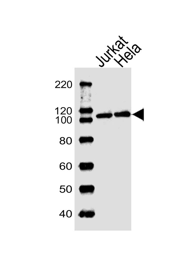 Lane 1: Jurkat Cell lysates; Lane 2: HeLa Cell lysates; probed with USP11 (2C9) Monoclonal Antibody, unconjugated (bsm-51399M) at 1:1000 overnight at 4°C followed by a conjugated secondary antibody for 60 minutes at 37°C.