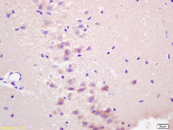 Formalin-fixed and paraffin embedded rat brain labeled with Anti-RASSF1A Polyclonal Antibody, Unconjugated (bs-1234R) at 1:200 followed by conjugation to the secondary antibody and DAB staining.