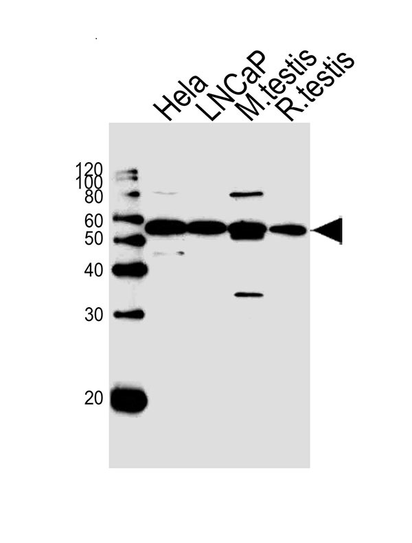 Lane 1: HeLa Cell lysates; Lane 2: LNCaP Cell lysates; Lane 3: Mouse testis lysates; Lane 4: Rat testis lysates; probed with ULK3 (4C5) Monoclonal Antibody, unconjugated (bsm-51408M) at 1:1000 overnight at 4°C followed by a conjugated secondary antibody for 60 minutes at 37°C.
