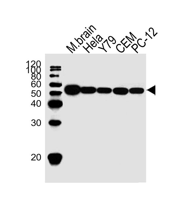 Lane 1: Mouse brain lysates; Lane 2: HeLa Cell lysates; Lane 3: Y79 Cell lysates; Lane 4: CEM Cell lysates; Lane 5: PC-12 Cell lysates; probed with TBB5 (7D3) Monoclonal Antibody, unconjugated (bsm-51387M) at 1:1000 overnight at 4°C followed by a conjugated secondary antibody for 60 minutes at 37°C.