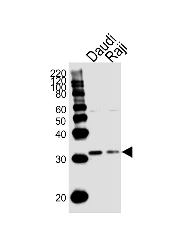 Lane 1: Daudi Cell lysates; Lane 2: Raji Cell lysates; probed with BCL10 (5C2) Monoclonal Antibody, unconjugated (bsm-51398M) at 1:1000 overnight at 4°C followed by a conjugated secondary antibody for 60 minutes at 37°C.