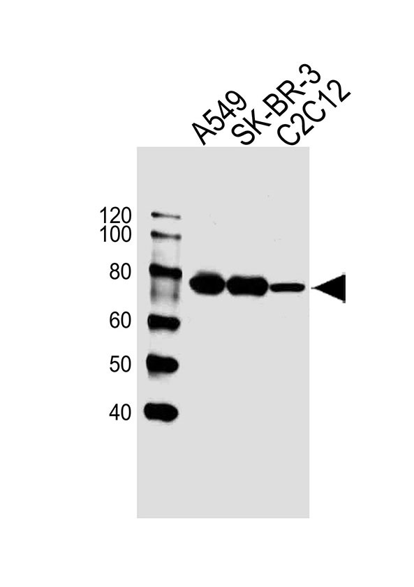 Lane 1: A549 Cell lysates; Lane 2: SK-BR-3 Cell lysates; Lane 3: C2C12 Cell lysates; probed with CAPN2 (1C1) Monoclonal Antibody, unconjugated (bsm-51429M) at 1:1000 overnight at 4°C followed by a conjugated secondary antibody for 60 minutes at 37°C.
