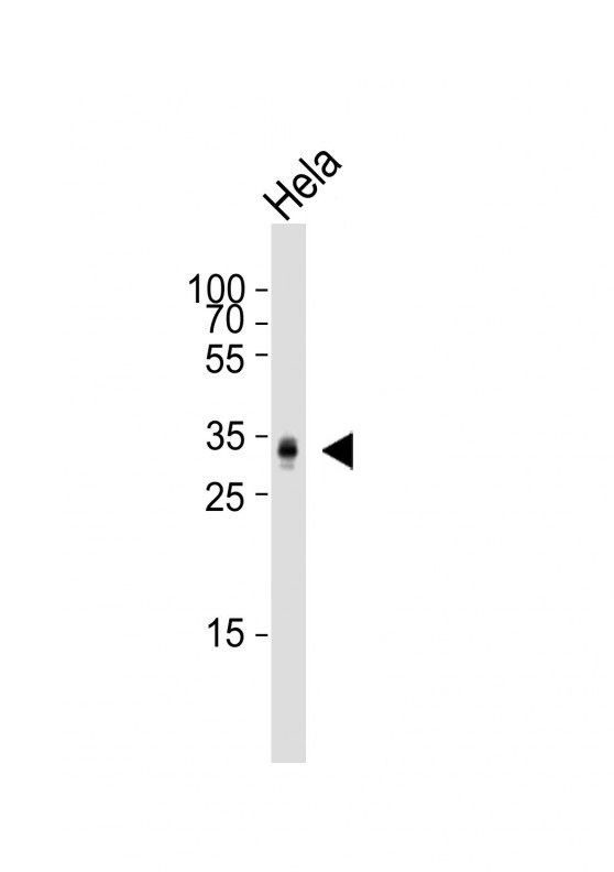HeLa Cell lysates; probed with PPT1 (10G4) Monoclonal Antibody, unconjugated (bsm-51262M) at 1:2000 overnight at 4°C followed by a conjugated secondary antibody for 60 minutes at 37°C.