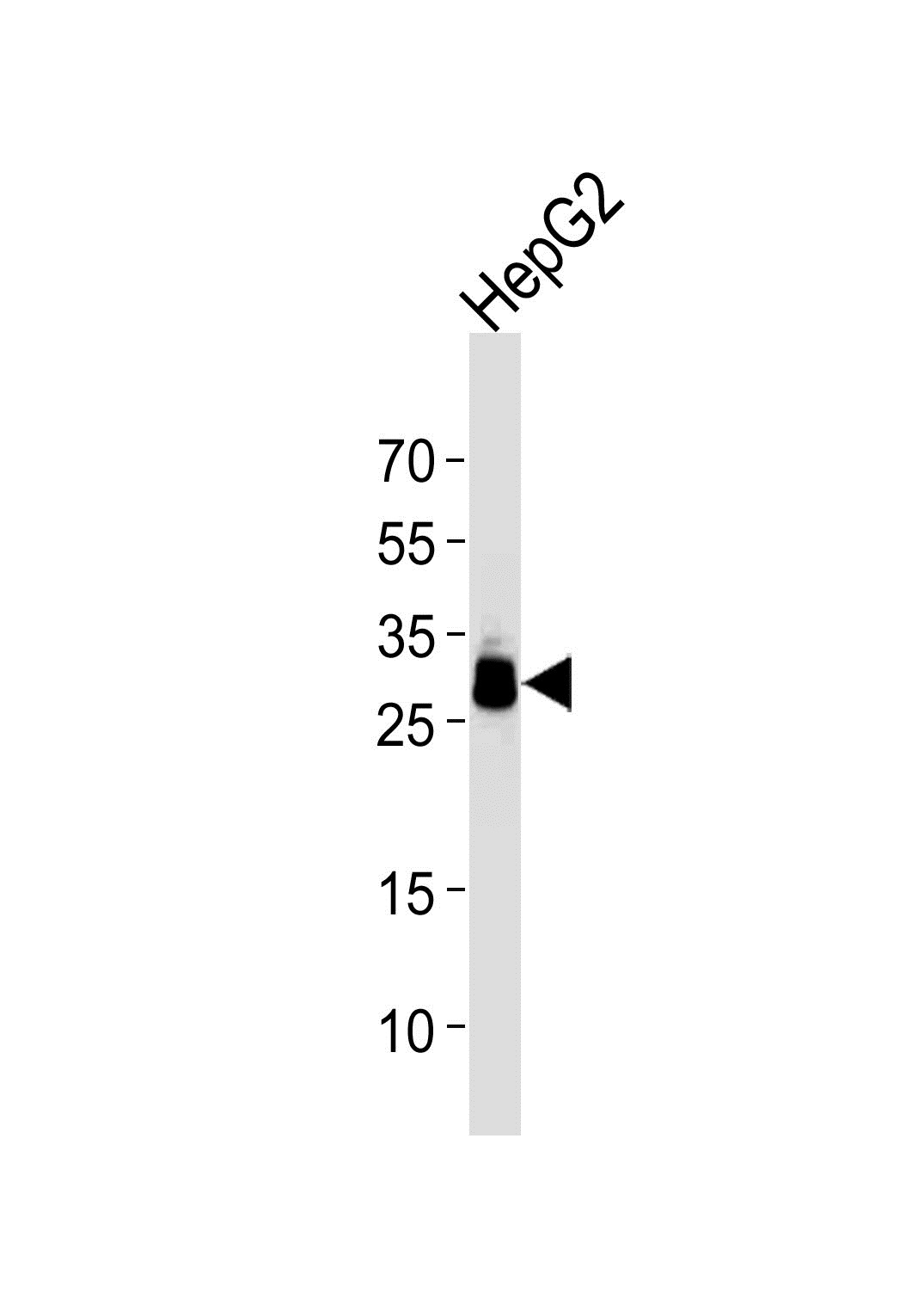 HepG2 Cell lysates; probed with PPT1 (10G4) Monoclonal Antibody, unconjugated (bsm-51262M) at 1:1000 overnight at 4°C followed by a conjugated secondary antibody for 60 minutes at 37°C.