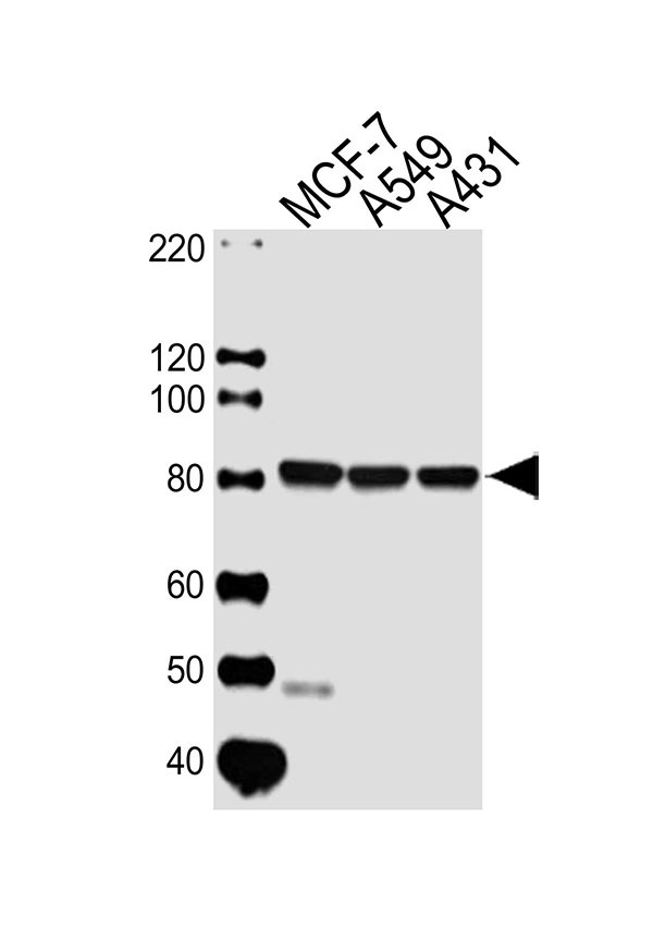 Lane 1: MCF-7 Cell lysates; Lane 2: A549 Cell lysates; Lane 3: A431 Cell lysates; probed with CAPN1 (6C5) Monoclonal Antibody, unconjugated (bsm-51419M) at 1:1000 overnight at 4°C followed by a conjugated secondary antibody for 60 minutes at 37°C.