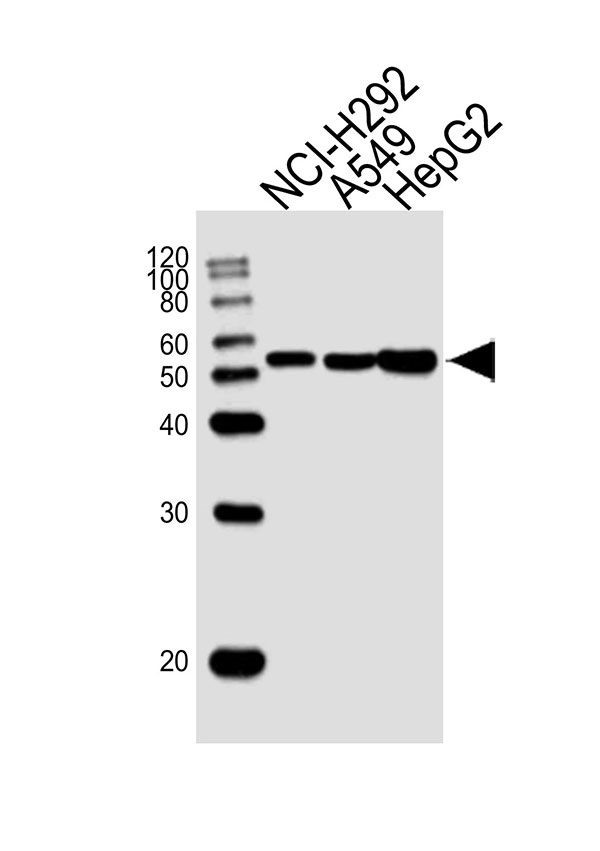 Lane 1: NCI-H292 Cell lysates; Lane 2: A549 Cell lysates; Lane 3: HepG2 Cell lysates; probed with ALDH2 (138CT22.3.8) Monoclonal Antibody, unconjugated (bsm-51417M) at 1:1000 overnight at 4°C followed by a conjugated secondary antibody for 60 minutes at 37°C.