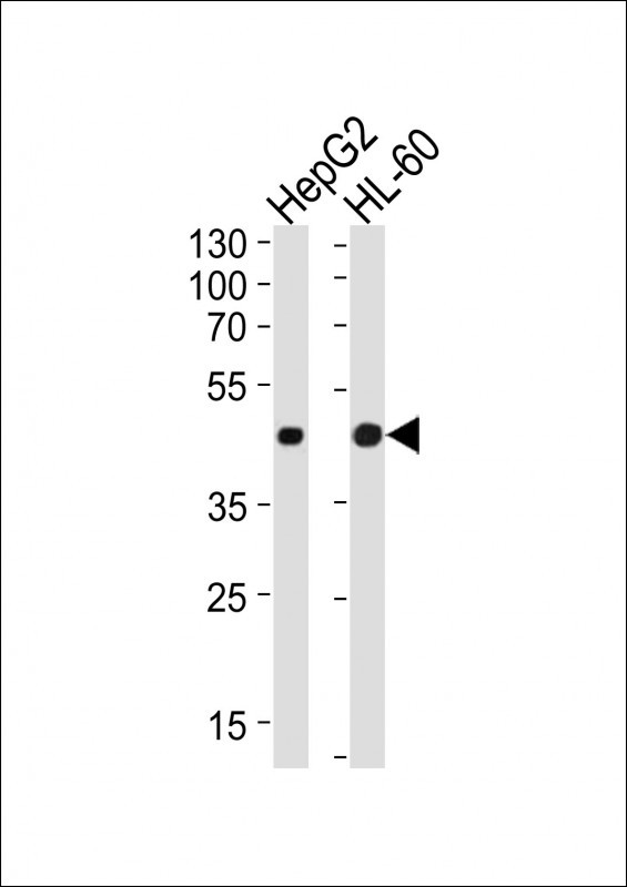 Lane 1: HepG2 Cell lysates; Lane 2: HL-60 Cell lysates; probed with Beta-actin (8H10D10) Monoclonal Antibody, unconjugated (bsm-51011M) at 1:1000 overnight at 4°C followed by a conjugated secondary antibody for 60 minutes at 37°C. Lane 1: HepG2 Cell lysates; Lane 2: HL-60 Cell lysates; probed with Beta-actin (8H10D10) Monoclonal Antibody, unconjugated (bsm-51011M) at 1:1000 overnight at 4°C followed by a conjugated secondary antibody for 60 minutes at 37°C.