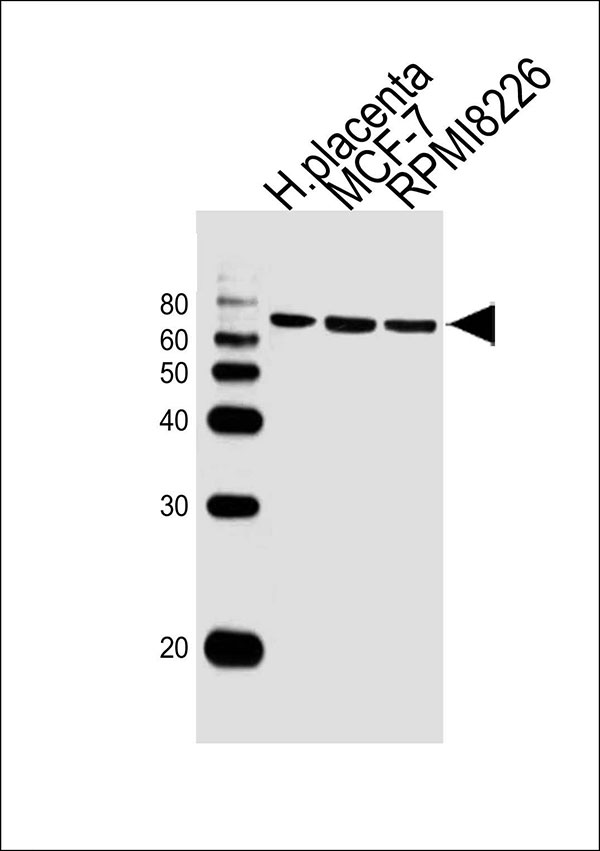 Lane 1: Sample Tissue/Cell lysates; Lane 2: Sample Tissue/Cell lysates; Lane 3: Sample Tissue/Cell lysates; probed with antibodyname Monoclonal Antibody, unconjugated (bsm-51388M) at 1:1000 overnight at 4°C followed by a conjugated secondary antibody for 60 minutes at 37°C.