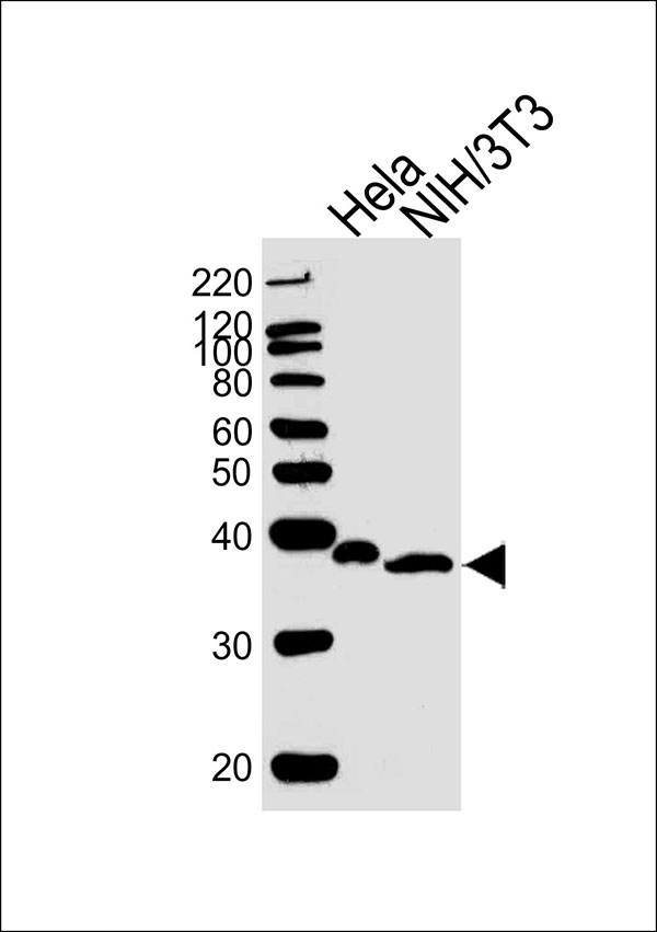Lane 1: Hela Cell lysates; Lane 2: NIH/3T3 Cell lysates; probed with NFKBIA (1121CT8.6.1) Monoclonal Antibody, unconjugated (bsm-51393M) at 1:1000 overnight at 4°C followed by a conjugated secondary antibody for 60 minutes at 37°C.