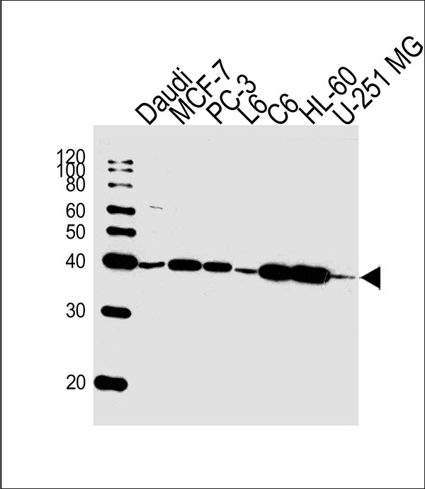 Lane 1: Daudi Cell lysates; Lane 2: MCF-7 Cell lysates; Lane 3: PC-3 Cell lysates; Lane 4: L6 Cell lysates; Lane 5: C6 Cell lysates; Lane 6: HL-60 Cell lysates; Lane 7: U-251 MG Cell lysates; probed with CREB3L4 (1165CT16.1.1) Monoclonal Antibody, unconjugated (bsm-51394M) at 1:1000 overnight at 4°C followed by a conjugated secondary antibody for 60 minutes at 37°C.