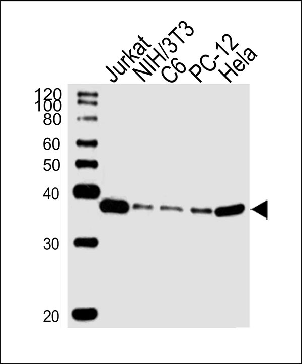 Lane 1: Jurkat Cell lysates; Lane 2: NIH/3T3 Cell lysates; Lane 3: C6 Cell lysates; Lane 4: PC-12 Cell lysates; Lane 5: Hela Cell lysates; probed with RAD51 (1C9) Monoclonal Antibody, unconjugated (bsm-51402M) at 1:1000 overnight at 4°C followed by a conjugated secondary antibody for 60 minutes at 37°C.