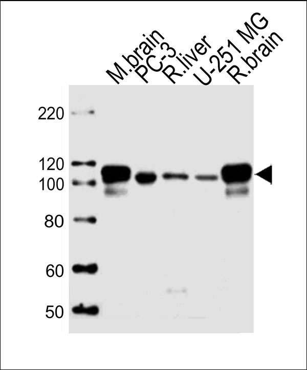 Lane 1: mouse brain lysates; Lane 2: PC-3 Cell lysates; Lane 3: rat liver Cell lysates; Lane 4: U-251 MG Cell lysates; Lane 5: rat brain Cell lysates; probed with USP5 (13C4)) Monoclonal Antibody, unconjugated (bsm-51404M) at 1:1000 overnight at 4°C followed by a conjugated secondary antibody for 60 minutes at 37°C.