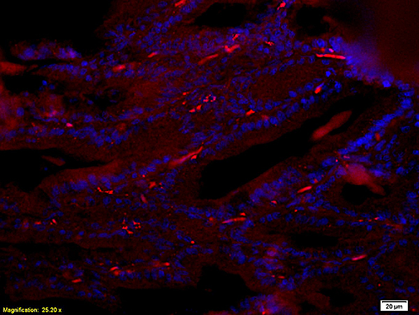 Formalin-fixed and paraffin-embedded : rat breast tissue labeled with Rabbit Anti-Reprimo Polyclonal Antibody (bs-1885R), Unconjugated 1:200 followed by conjugation to the secondary PE antibody and DABI staining