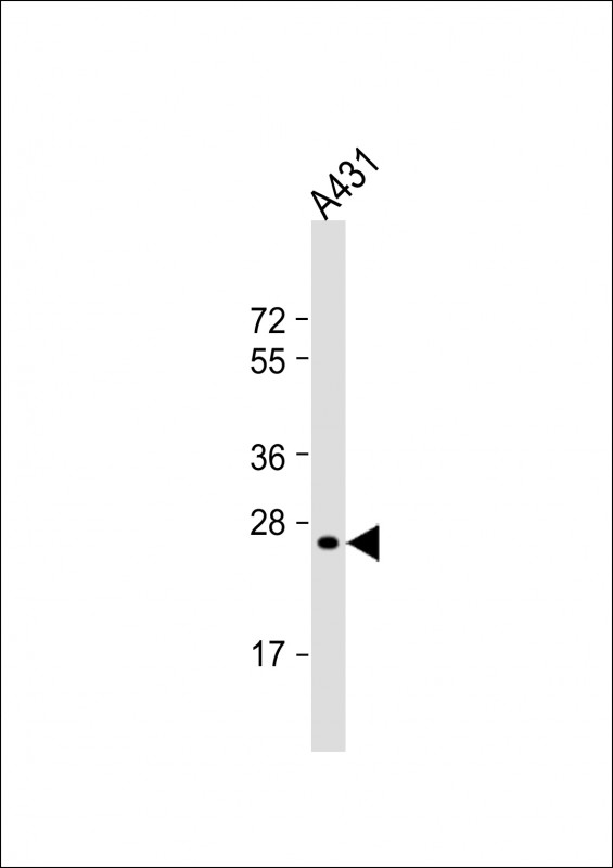 A431 cell lysate (20ug) probed with RAB5B (5C5) Monoclonal Antibody, unconjugated (bsm-51341M) at 1:2000 overnight at 4°C followed by a conjugated secondary antibody for 60 minutes at Room Temperature.