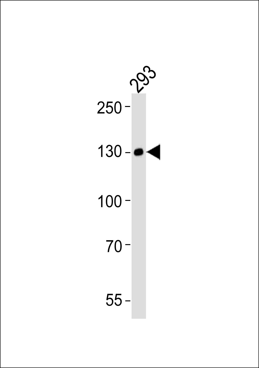 Lane 1: 293 Cell lysates; probed with EPHA6 (6C9) Monoclonal Antibody, unconjugated (bsm-51286M) at 1:1000 overnight at 4°C followed by a conjugated secondary antibody for 60 minutes at 37°C.