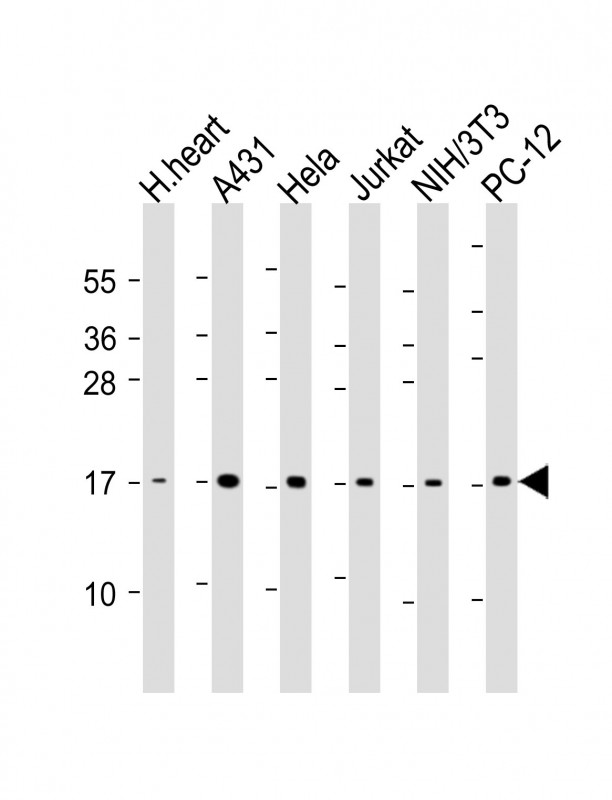 Lane 1: human heart lysate; Lane 2: A431 whole cell lysate; Lane 3: Hela whole cell lysate; Lane 4: Jurkat whole cell lysate; Lane 5: NIH/3T3 whole cell lysate; Lane 6: PC-12 whole cell lysate at 20 µg per lane; probed with bsm-51021M UBC9 (67AT1273.95.90) Monoclonal Antibody at 1:1000 dilution and 4℃ overnight incubation, followed by secondary antibody incubation for 60min at room temperature.