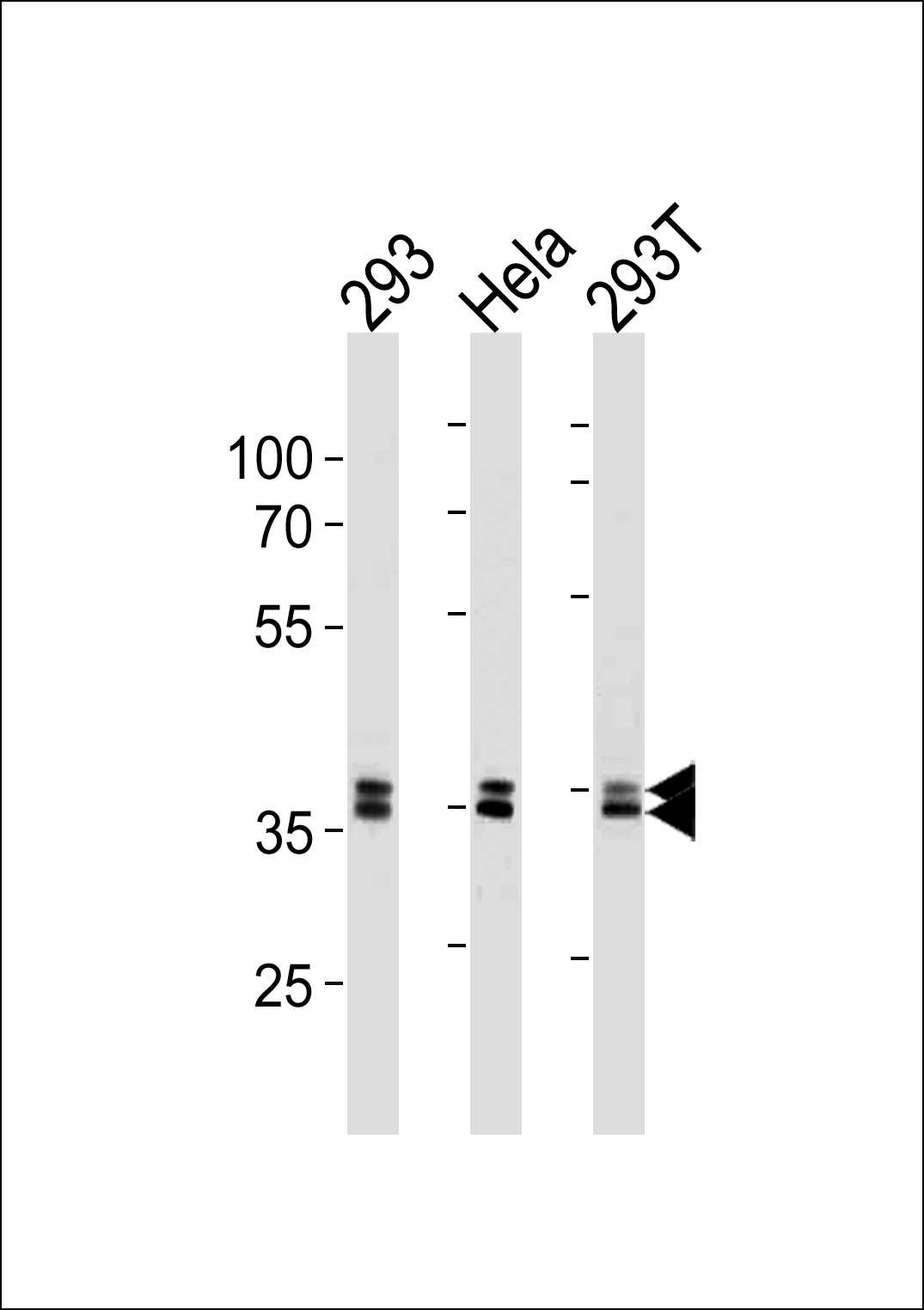 Lane 1: 293 Cell lysates; Lane 2: HeLa Cell lysates; Lane 3: 293T Cell lysates; probed with UCH37 (8G6) Monoclonal Antibody, unconjugated (bsm-51223M) at 1:1000 overnight at 4°C followed by a conjugated secondary antibody for 60 minutes at 37°C.