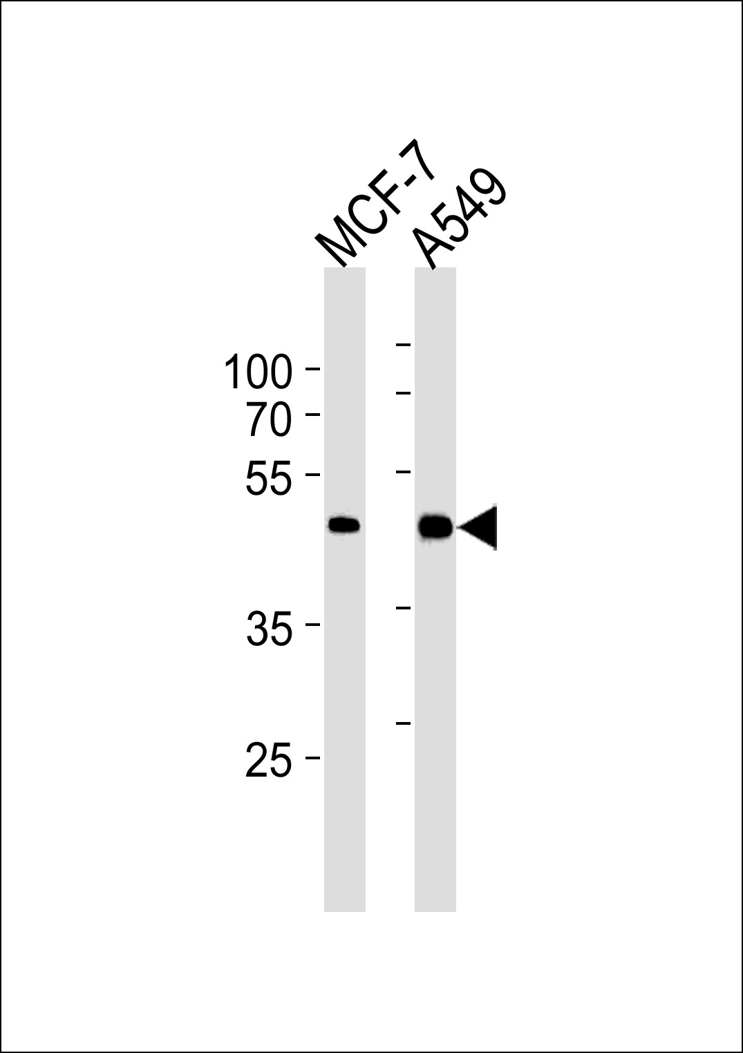 Lane 1: MCF-7 Cell lysates; Lane 2: A549 Cell lysates; probed with CCRK (885CT27.1.1) Monoclonal Antibody, unconjugated (bsm-51231M) at 1:1000 overnight at 4°C followed by a conjugated secondary antibody for 60 minutes at 37°C.