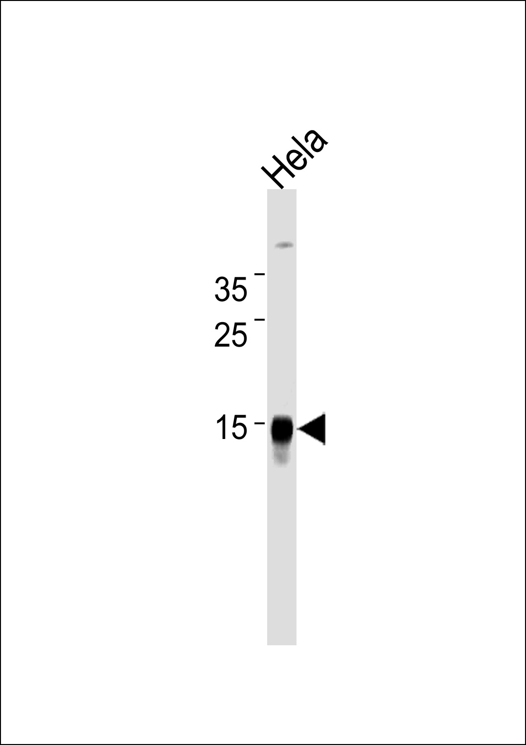 Lane 1: HeLa Cell lysates; probed with CDA (921CT14.2.1) Monoclonal Antibody, unconjugated (bsm-51235M) at 1:1000 overnight at 4°C followed by a conjugated secondary antibody for 60 minutes at 37°C.