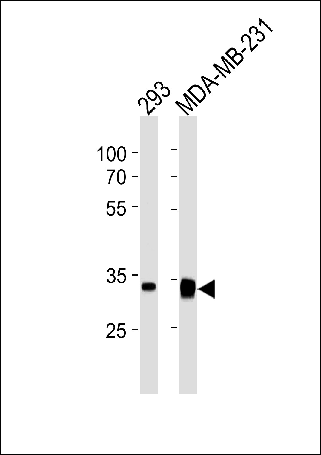 Lane 1: 293 lysates; Lane 2: MDA-MB-231 Cell lysates; probed with GOLPH3 (9A1) Monoclonal Antibody, unconjugated (bsm-51236M) at 1:1000 overnight at 4°C followed by a conjugated secondary antibody for 60 minutes at 37°C.