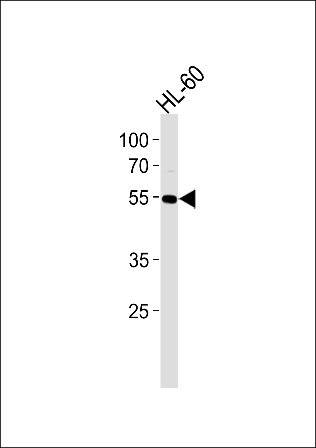 Lane 1: HL-60 Cell lysates; probed with AKT1 (6C1) Monoclonal Antibody, unconjugated (bsm-51238M) at 1:5000 overnight at 4°C followed by a conjugated secondary antibody for 60 minutes at 37°C. Lane 1: HL-60 Cell lysates; probed with AKT1 (6C1) Monoclonal Antibody, unconjugated (bsm-51238M) at 1:5000 overnight at 4°C followed by a conjugated secondary antibody for 60 minutes at 37°C.