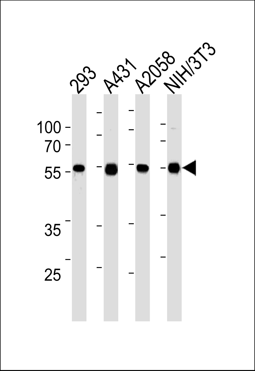 Lane 1: 293 Cell lysates; Lane 2: A431 Cell lysates; Lane 3: A2058 Cell lysates; Lane 4: NIH/3T3 Cell lysates; probed with TPIPb (8G4) Monoclonal Antibody, unconjugated (bsm-51240M) at 1:5000 overnight at 4°C followed by a conjugated secondary antibody for 60 minutes at 37°C.