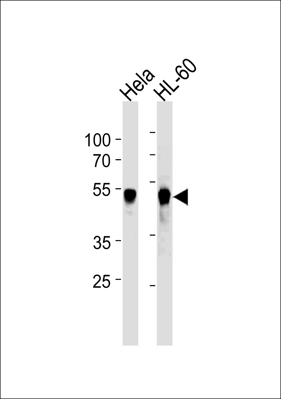 Lane 1: HeLa Cell lysates; Lane 2: HL-60Cell lysates; probed with VRK1 (1015CT2.1.1) Monoclonal Antibody, unconjugated (bsm-51242M) at 1:5000 overnight at 4°C followed by a conjugated secondary antibody for 60 minutes at 37°C.