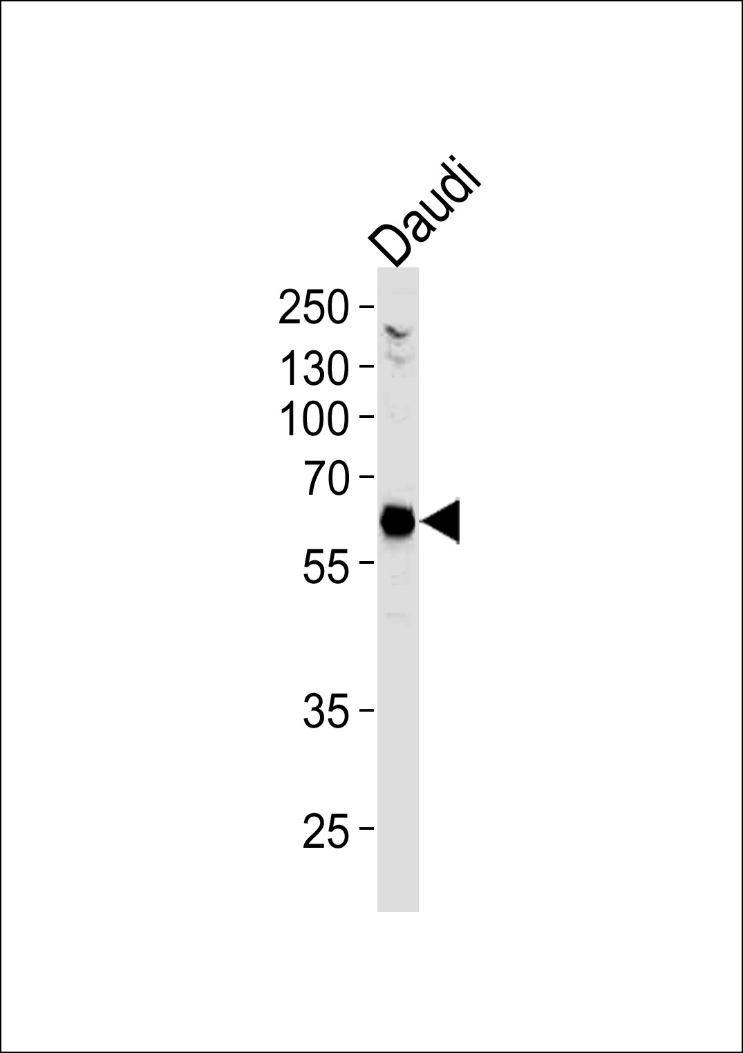 Lane 1: Daudi Cell lysates; probed with USP22 (4C1) Monoclonal Antibody, unconjugated (bsm-51243M) at 1:500 overnight at 4°C followed by a conjugated secondary antibody for 60 minutes at 37°C.