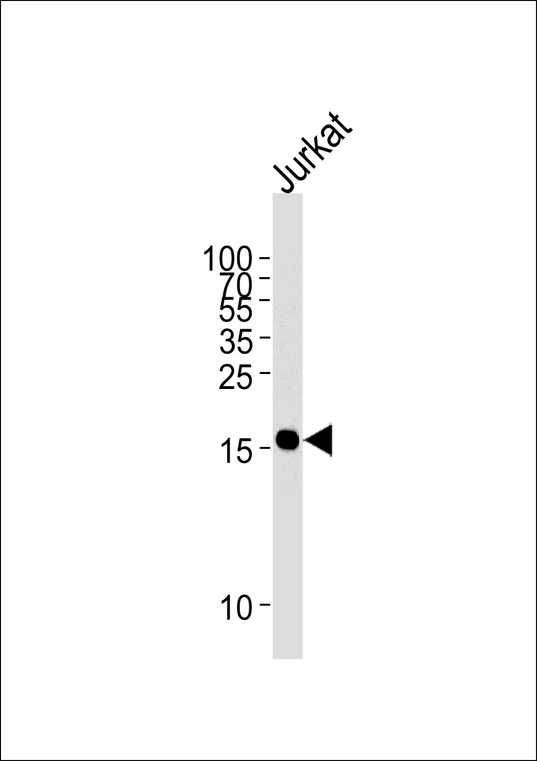 Lane 1: Jurkat Cell lysates; probed with GMFG (789CT20.3.1.1) Monoclonal Antibody, unconjugated (bsm-51244M) at 1:40000 overnight at 4°C followed by a conjugated secondary antibody for 60 minutes at 37°C.