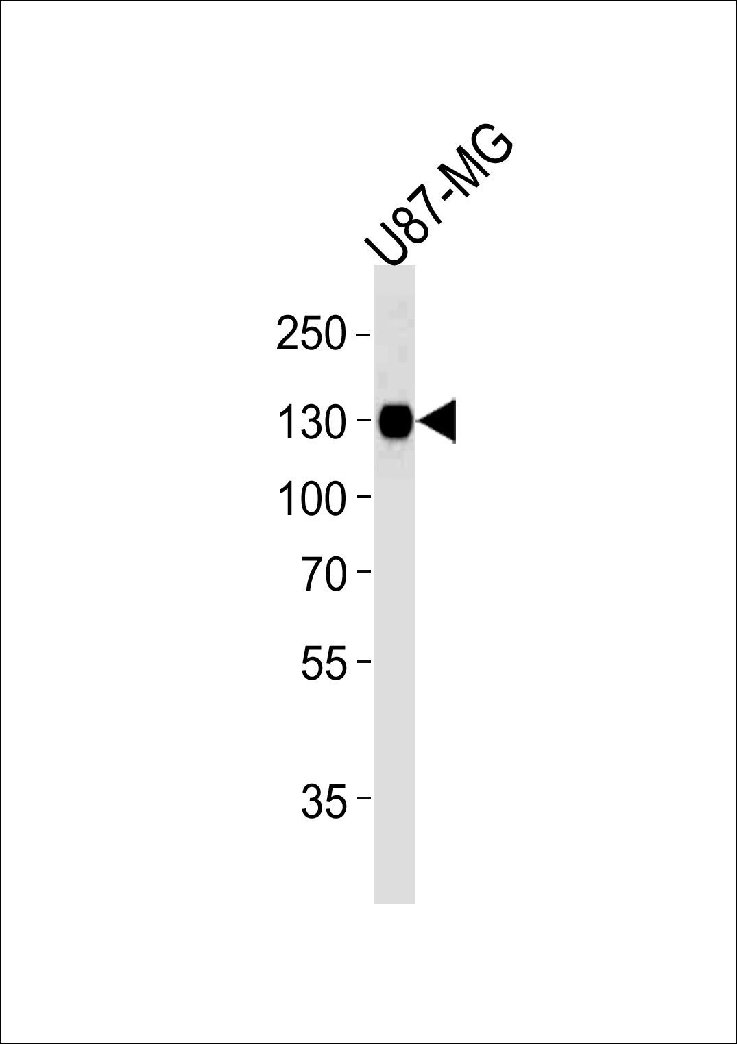 Lane 1: U87-MG Cell lysates; probed with ITGB1 (1084CT17.4.1) Monoclonal Antibody, unconjugated (bsm-51250M) at 1:1000 overnight at 4°C followed by a conjugated secondary antibody for 60 minutes at 37°C.