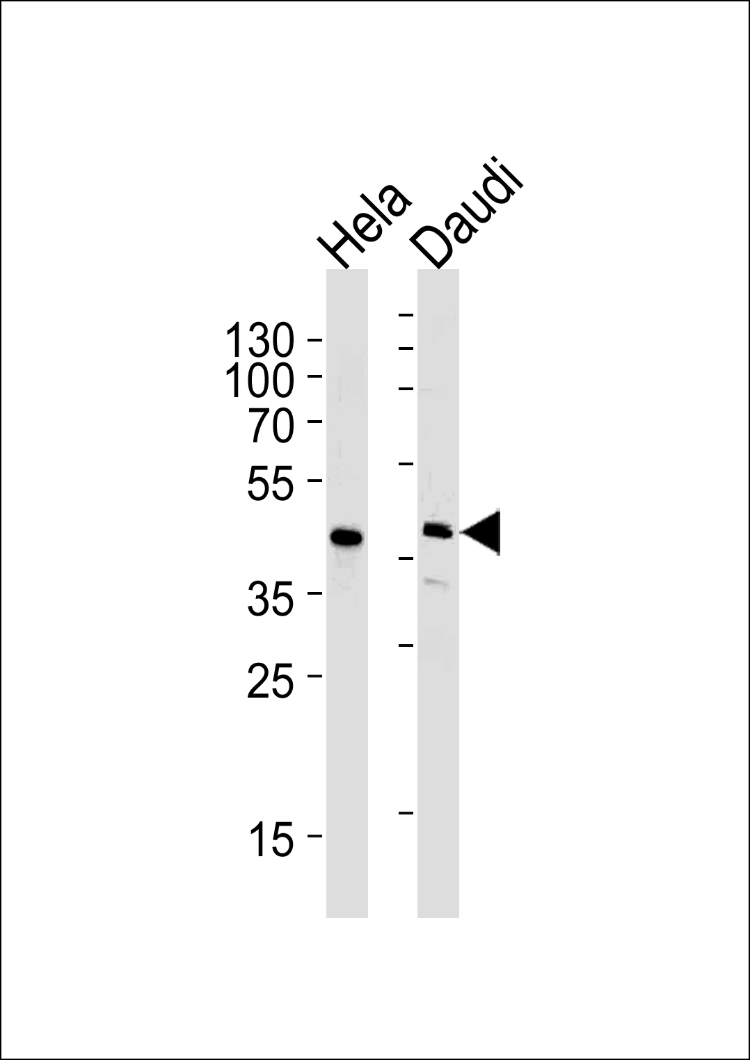 Lane 1: HeLa Cell lysates; Lane 2: Daudi Cell lysates; probed with USF1 (4C4) Monoclonal Antibody, unconjugated (bsm-51254M) at 1:1000 overnight at 4°C followed by a conjugated secondary antibody for 60 minutes at 37°C. Lane 1: HeLa Cell lysates; Lane 2: Daudi Cell lysates; probed with USF1 (4C4) Monoclonal Antibody, unconjugated (bsm-51254M) at 1:1000 overnight at 4°C followed by a conjugated secondary antibody for 60 minutes at 37°C.