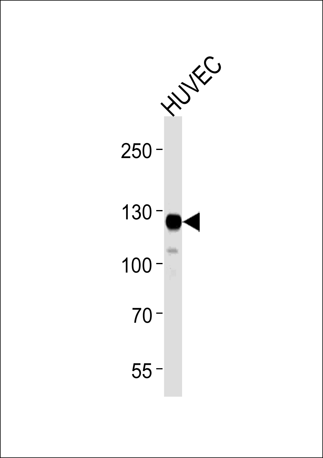 PTK2 probed with PTK2 (7C5) Monoclonal Antibody, unconjugated (bsm-51255M) at 1:1000 overnight at 4°C followed by a conjugated secondary antibody for 60 minutes at 37°C.