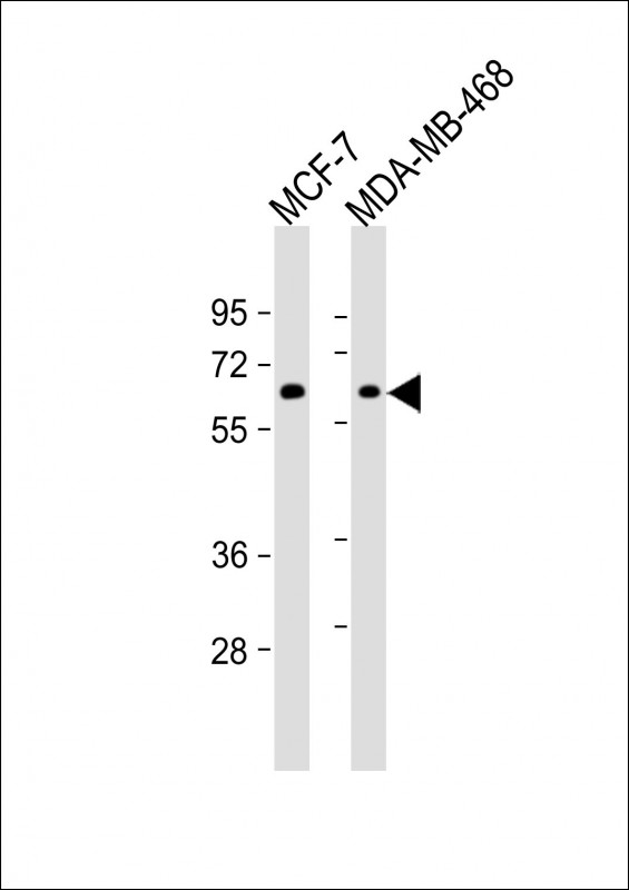 Lane 1: MCF-7; Lane 2: MDA-MB-468 whole cell lysate probed with bsm-51040M PRKAA1 (167CT22.1.6) Monoclonal Antibody at 1:1000 dilution and 4℃ overnight incubation, followed by secondary antibody incubation for 60min at room temperature.