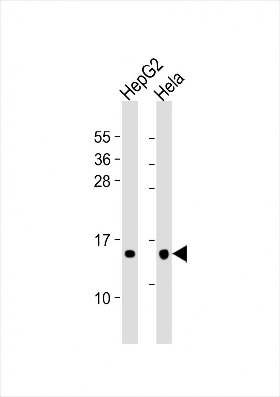Lane 1: HepG2; Lane 2: Hela whole cell lysate at 20µg per lane, probed with bsm-51041M THEM2 (169CT7.1.3) Monoclonal Antibody at 1:1000 dilution and 4℃ overnight incubation, followed by secondary antibody incubation for 60min at room temperature.