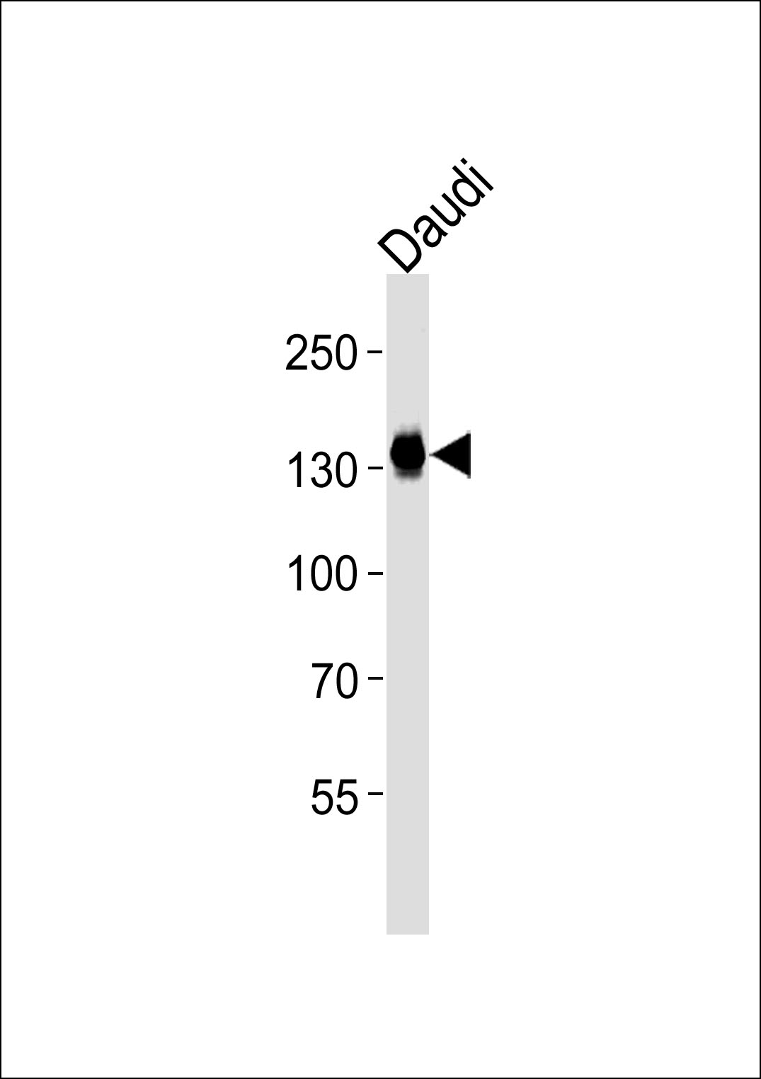 Lane 1: Daudi Cell lysates; probed with USP25 (7C1) Monoclonal Antibody, unconjugated (bsm-51259M) at 1:1000 overnight at 4°C followed by a conjugated secondary antibody for 60 minutes at 37°C.