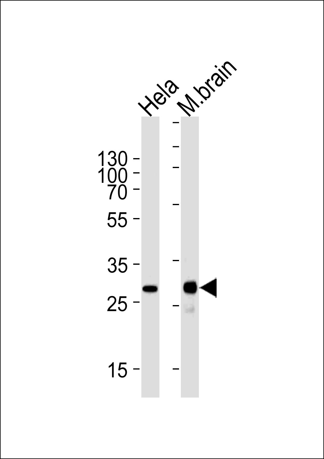 Lane 1: HeLa Cell lysates; Lane 2: mouse brain lysates; probed with CDK5 (1C9) Monoclonal Antibody, unconjugated (bsm-51261M) at 1:1000 overnight at 4°C followed by a conjugated secondary antibody for 60 minutes at 37°C.