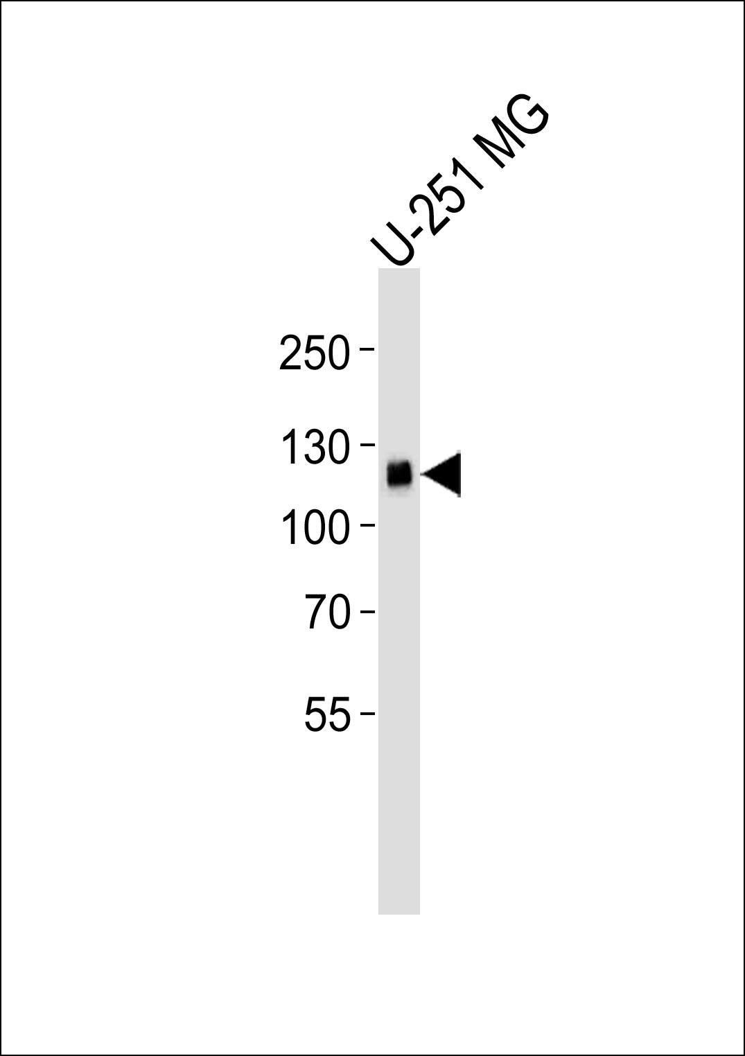 Lane 1: U-251 MG Cell lysates; probed with EPHA5 (46CT61.6.4) Monoclonal Antibody, unconjugated (bsm-51268M) at 1:1000 overnight at 4°C followed by a conjugated secondary antibody for 60 minutes at 37°C.