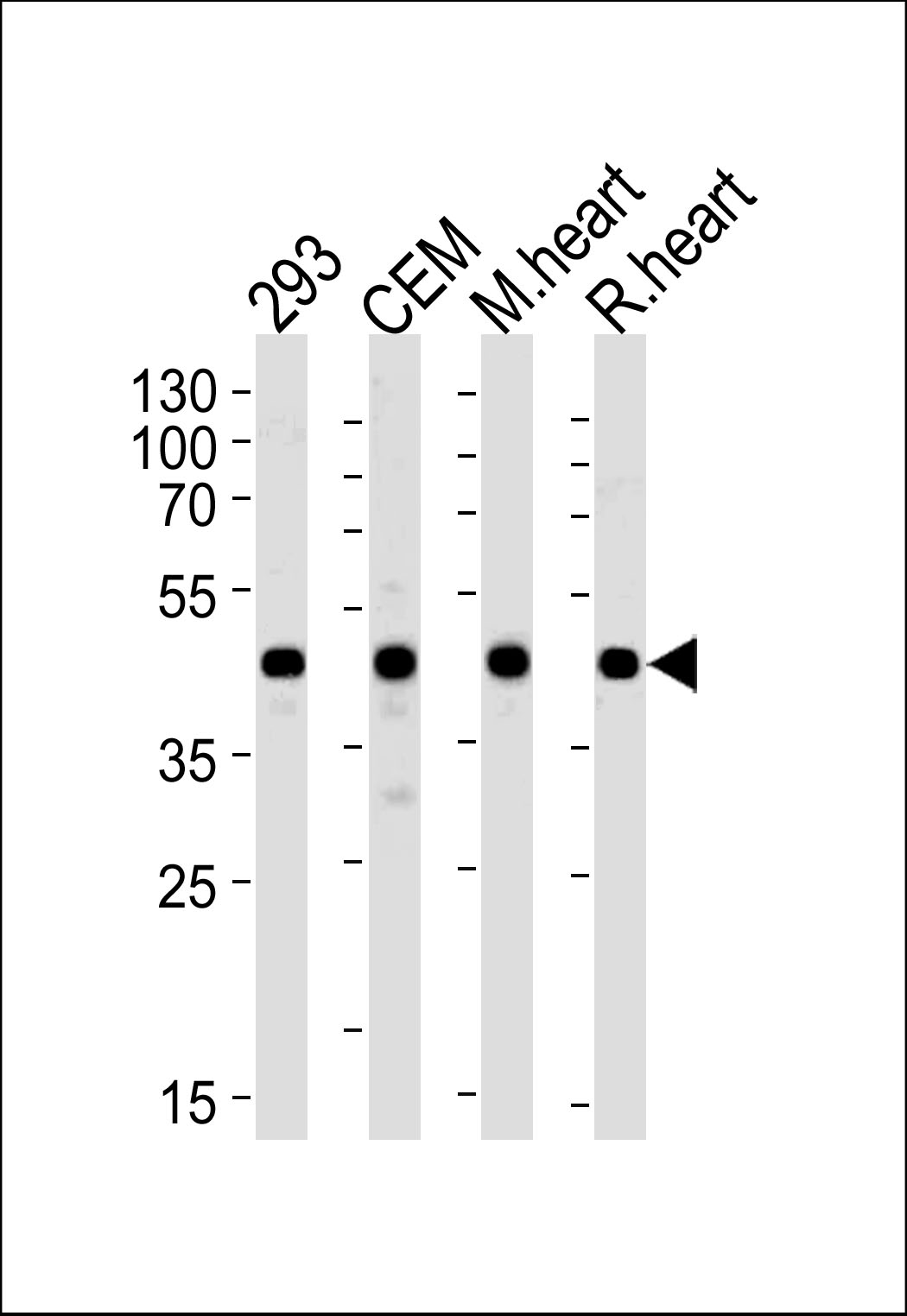 Lane 1: 293; Lane 2: CEM; Lane 3: mouse heart lysate; Lane 4: rat heart lysate at 20ug per lane, probed with bsm-51054M VEGFC (197CT7.3.4) Monoclonal Antibody at 1:2000 dilution and 4℃ overnight incubation, followed by secondary antibody incubation for 60min at room temperature.