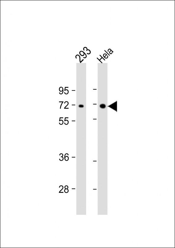 Lane 1: 293; Lane 2: Hela whole cell lysate at 20 µg per lane; probed with bsm-51055M PRKAA2 (206CT5.4.2) Monoclonal Antibody at 1:1000 dilution and 4℃ overnight incubation, followed by secondary antibody incubation for 60min at room temperature.