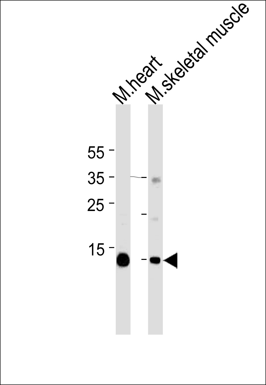 Lane 1: mouse heart lysates; Lane 2: mouse skeletal muscle lysates; probed with Myoglobin (773CT18.2.2) Monoclonal Antibody, unconjugated (bsm-51283M) at 1:1000 overnight at 4°C followed by a conjugated secondary antibody for 60 minutes at 37°C.