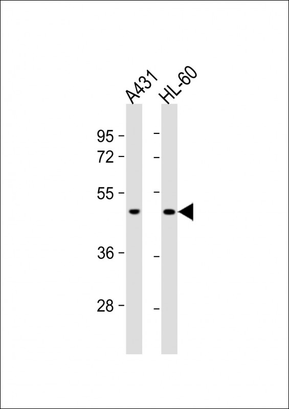 Lane 1: A431; Lane 2: HL-60 cell lysates; probed with ATG4D (222CT15.4.1) Monoclonal Antibody, unconjugated (bsm-51061M) at 1:1000 overnight at 4°C followed by a conjugated secondary antibody for 60 minutes at 37°C.