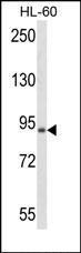 Lane 1: HL-60 Cell lysates; probed with BRAF (125CT13.3.5) Monoclonal Antibody, unconjugated (bsm-51025M) at 1:1000 overnight at 4°C followed by a conjugated secondary antibody for 60 minutes at 37°C.