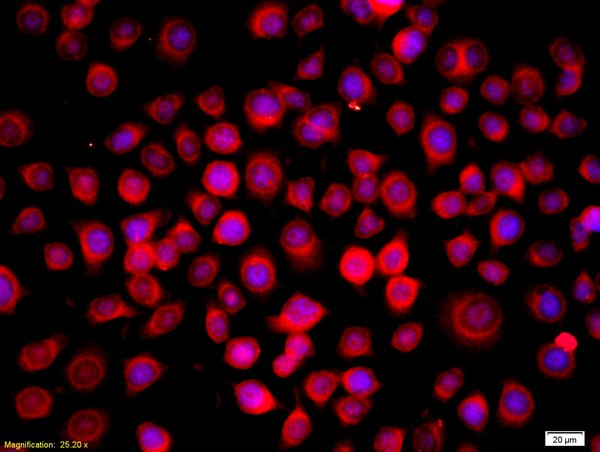 Formalin-fixed and paraffin-embedded human oral squamous cell labeled with Anti-RASSF1A Polyclonal Antibody, Unconjugated(bs-1234R) 1:200, overnight at 4\u00b0C, The secondary antibody was Goat Anti-Rabbit IgG, PE conjugated(bs-0295G-PE)used at 1:200 dilution for 40 minutes at 37\u00b0C.