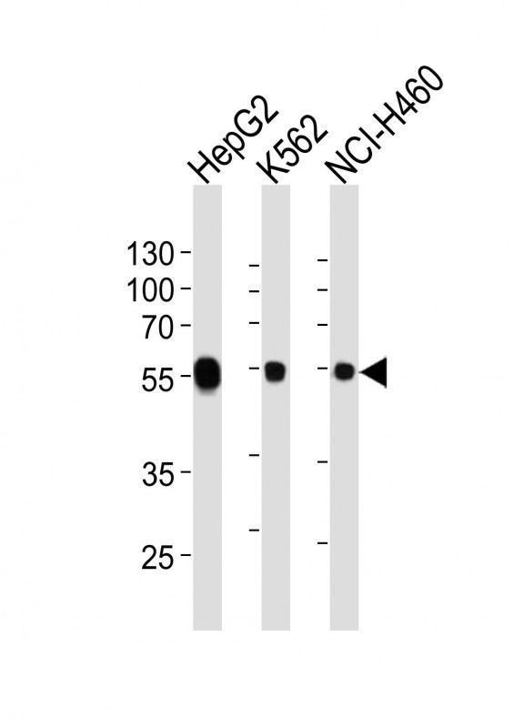 Lane 1: HepG2 Cell lysates; Lane 2: K562 Cell lysates; Lane 3: NCI-H460 Cell lysates; probed with ALDH1A1 (2C2) Monoclonal Antibody, unconjugated (bsm-51032M) at 1:1000 overnight at 4°C followed by a conjugated secondary antibody for 60 minutes at 37°C.