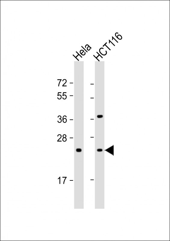 Lane 1: HeLa; Lane 2: HCT116 lysate at 20 µg per lane. probed with bsm-51077M RAB8A (261CT1.3.1) Monoclonal Antibody at 1:1000 dilution and 4℃ overnight incubation, followed by secondary antibody incubation for 60min at room temperature.