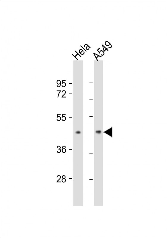 Lane 1: HeLa; Lane 2: A549 lysate at 20 µg per lane, probed with bsm-51082M BMI1 (282CT3.7.6) Monoclonal Antibody at 1:1000 dilution and 4℃ overnight incubation, followed by secondary antibody incubation for 60min at room temperature. Lane 1: HeLa; Lane 2: A549 lysate at 20 µg per lane, probed with bsm-51082M BMI1 (282CT3.7.6) Monoclonal Antibody at 1:1000 dilution and 4℃ overnight incubation, followed by secondary antibody incubation for 60min at room temperature.