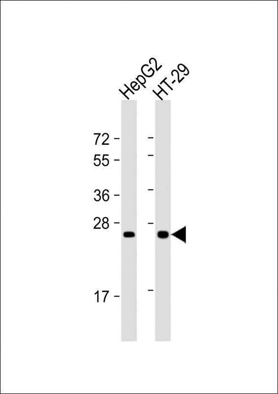 Lane 1: HepG2; Lane 2: HT-29 lysate at 20 µg per lane, probed with bsm-51090M Glucagon (329CT36.10.10) Monoclonal Antibody at 1:1000 dilution and 4℃ overnight incubation, followed by secondary antibody incubation for 60min at room temperature.