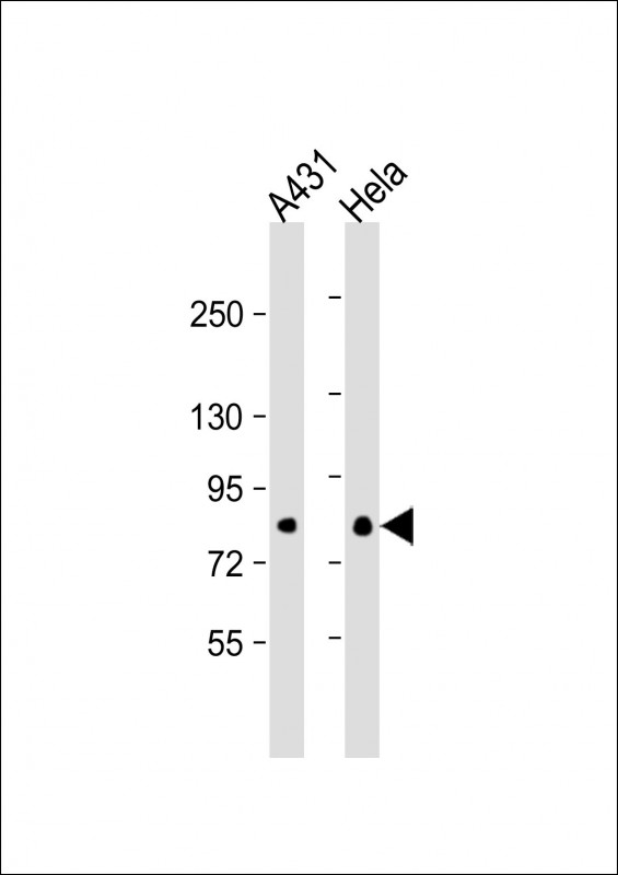 Lane 1: A431; Lane 2: HeLa cell lysate at 20 µg per lane. probed with bsm-51102M EIF4B (355CT12.6.5) Monoclonal Antibody at 1:1000 dilution and 4℃ overnight incubation, followed by secondary antibody incubation for 60min at room temperature.
